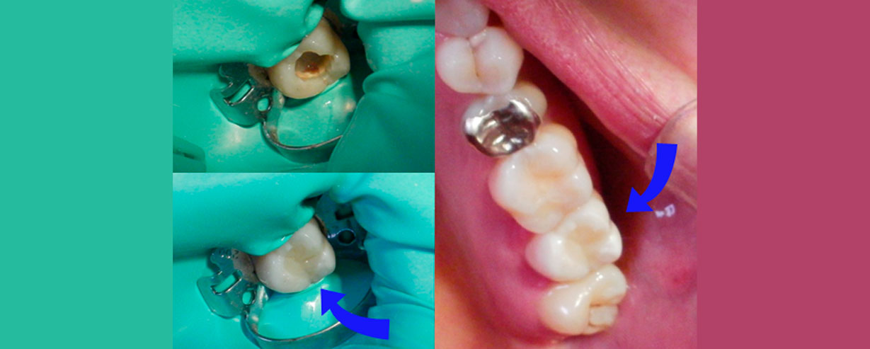EndodonciA 001