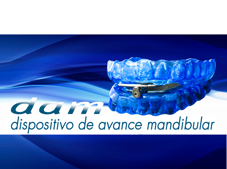 DAM-Dispositivo Avance Mandibular